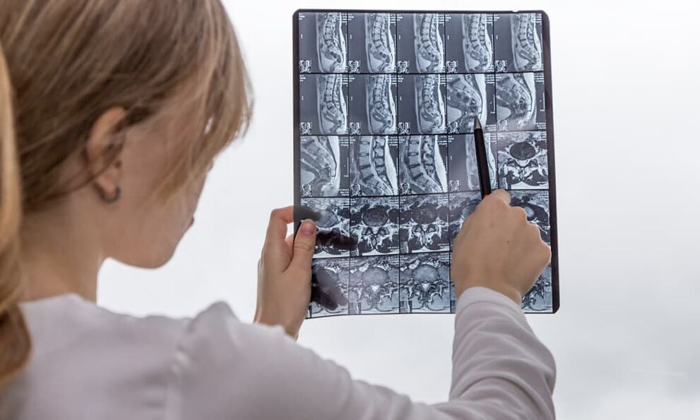 Magnetic resonance imaging will help doctors identify osteochondrosis and prescribe treatment