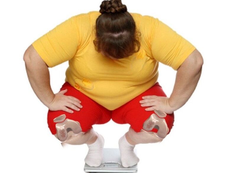 Among patients with arthrosis, the majority are overweight or obese